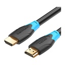 Vention® HDMI Cable 1.5M Black (AACBG)